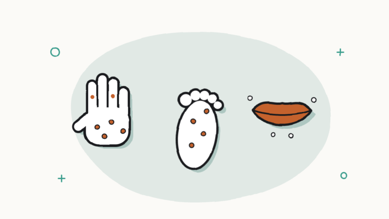 Una mano, un pie y una boca con pequeñas ampollas naranjas